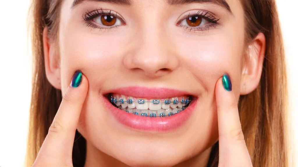 12 Dos and Don’ts of Braces for a Radiant Transformation
