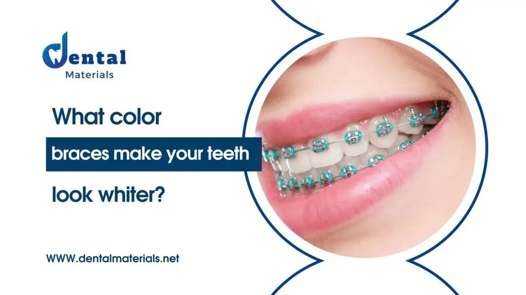 What color braces make your teeth look whiter